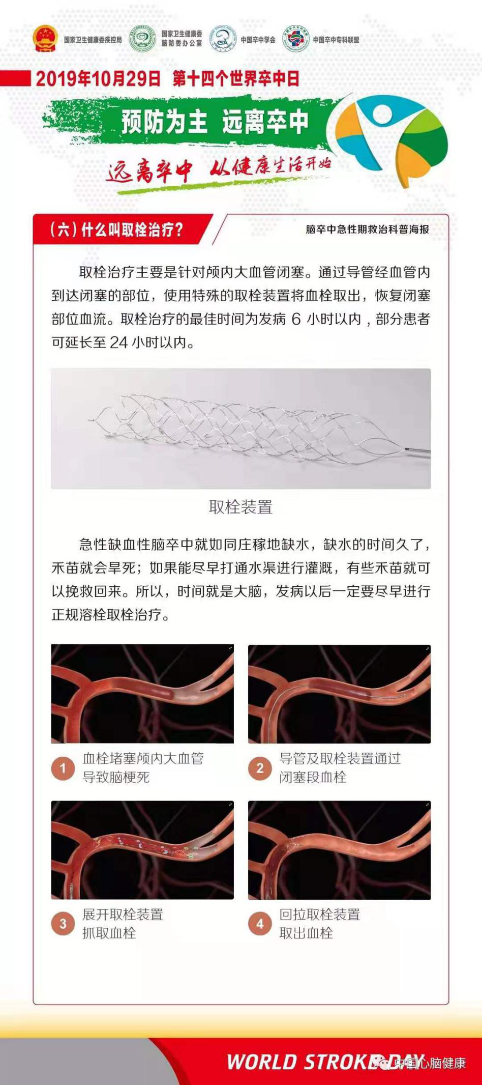 世界卒中日|遠(yuǎn)離卒中 從健康生活開始