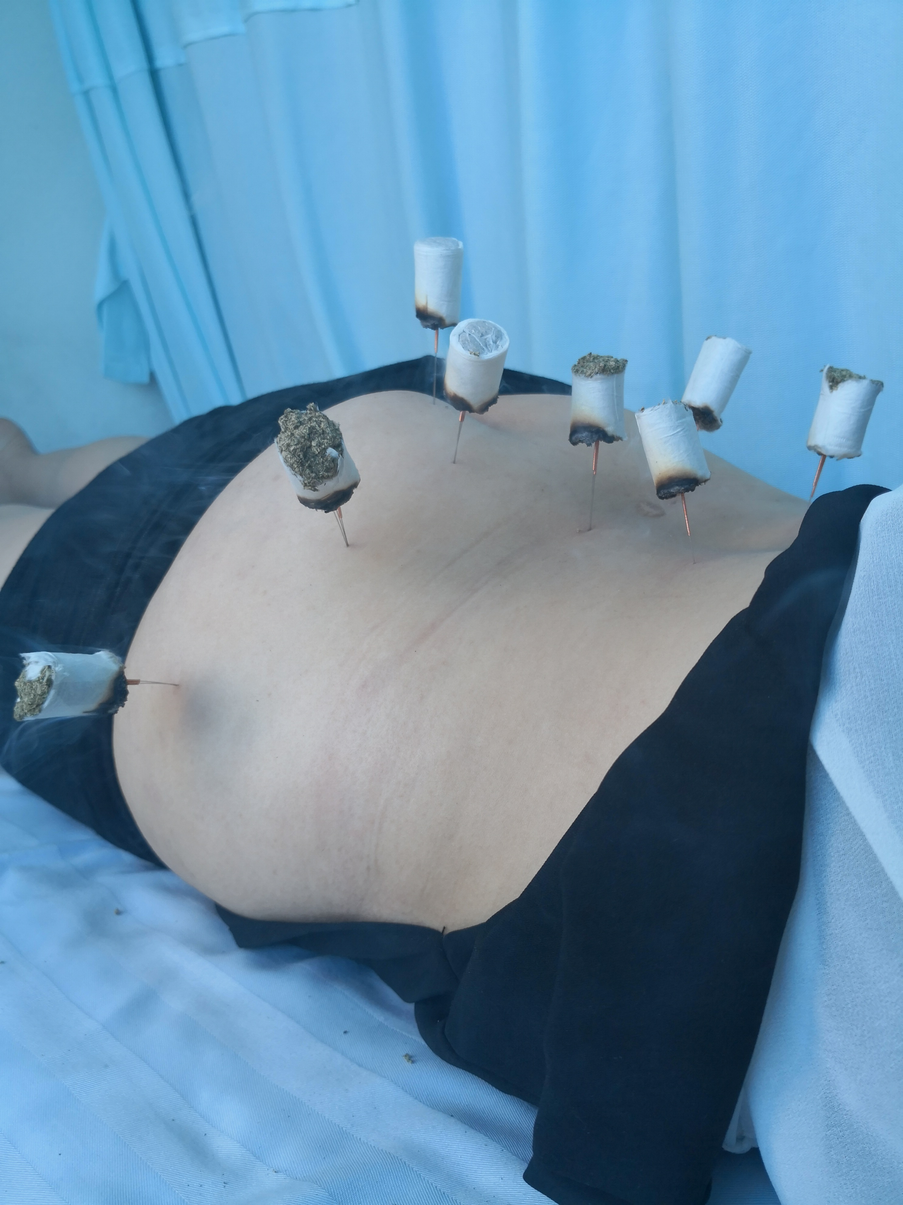 特色療法贏信任 妙手施治創(chuàng)佳話