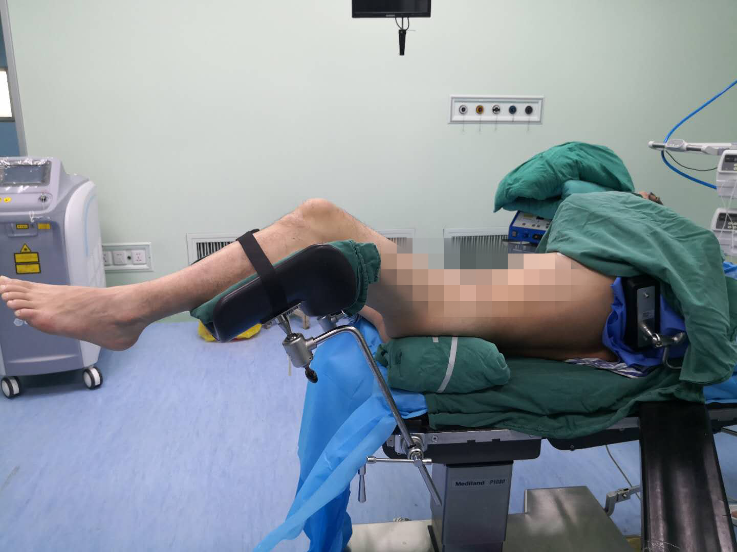 贊！不用開刀就能把腎臟內(nèi)8公分大的囊腫取出來