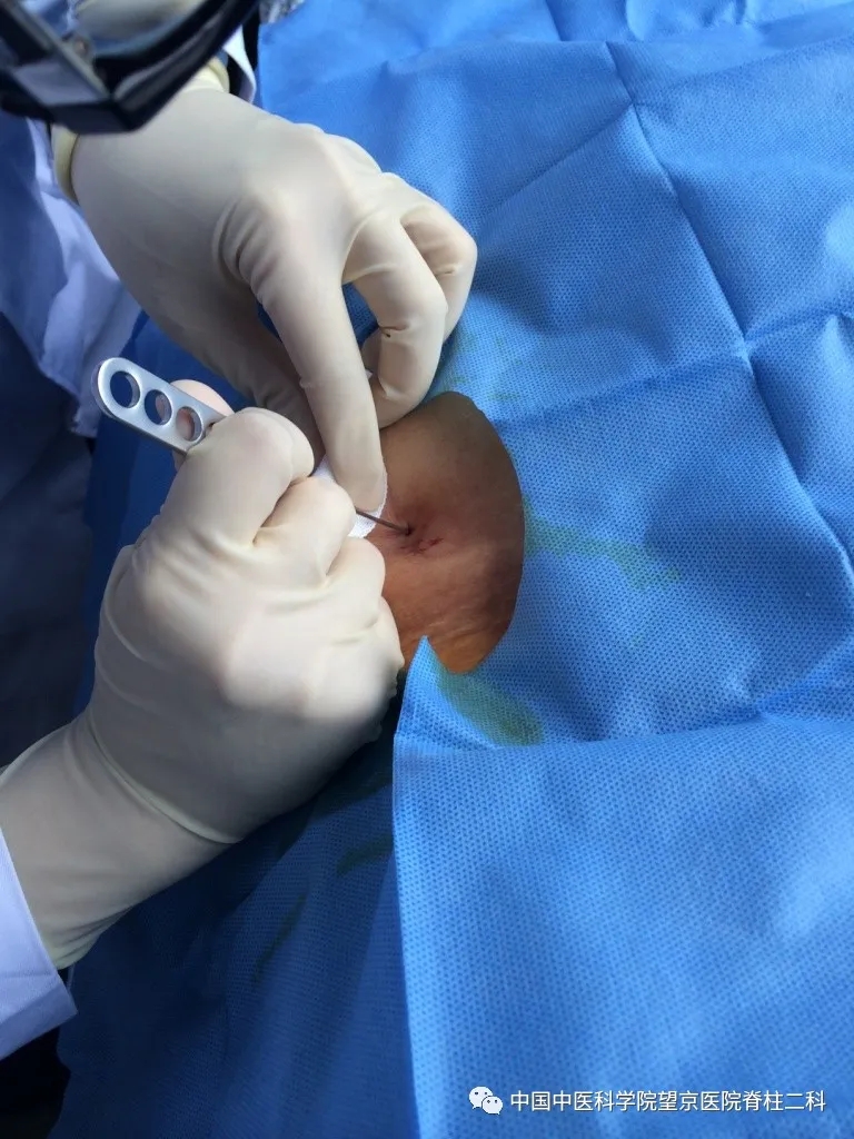 【醫(yī)訊】中國中醫(yī)科學(xué)院望京醫(yī)院楊克新專家團(tuán)隊(duì)9月18日—19日到漳州市中醫(yī)院坐診