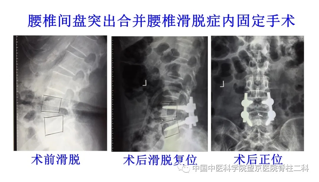 【醫(yī)訊】中國中醫(yī)科學(xué)院望京醫(yī)院楊克新專家團(tuán)隊(duì)9月18日—19日到漳州市中醫(yī)院坐診