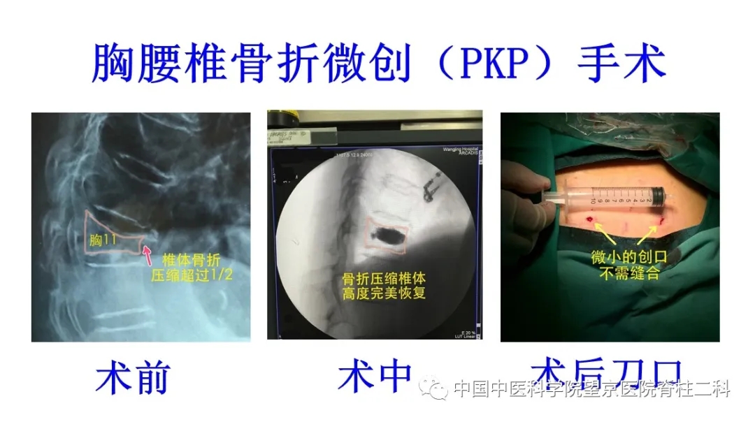 【醫(yī)訊】中國中醫(yī)科學(xué)院望京醫(yī)院楊克新專家團(tuán)隊(duì)9月18日—19日到漳州市中醫(yī)院坐診