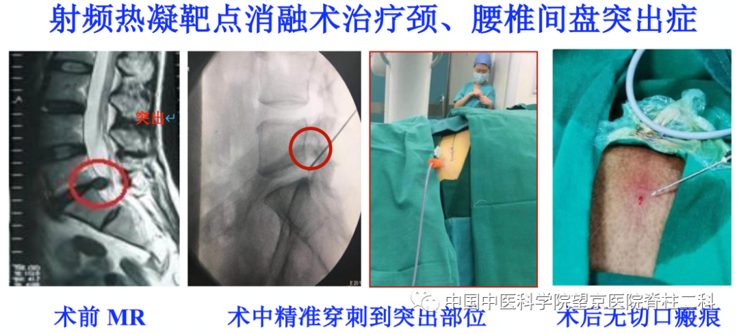 【醫(yī)訊】中國中醫(yī)科學(xué)院望京醫(yī)院楊克新專家團(tuán)隊(duì)9月18日—19日到漳州市中醫(yī)院坐診