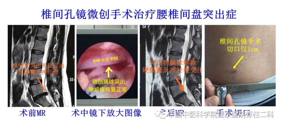 【醫(yī)訊】中國中醫(yī)科學(xué)院望京醫(yī)院楊克新專家團(tuán)隊(duì)9月18日—19日到漳州市中醫(yī)院坐診