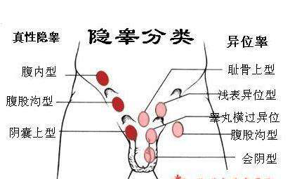 消失的“蛋蛋”去哪兒了