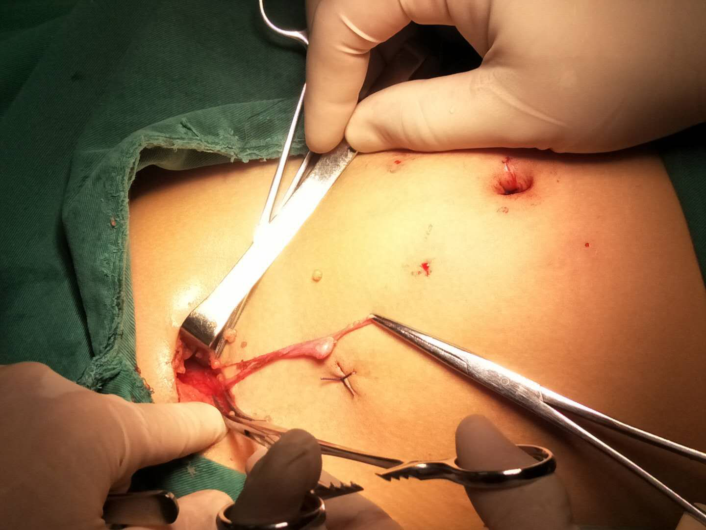 消失的“蛋蛋”去哪兒了