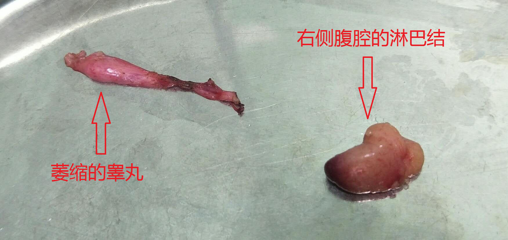 消失的“蛋蛋”去哪兒了