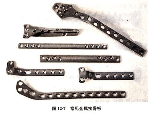 骨折了，醫(yī)生為什么不馬上給我動手術(shù)？