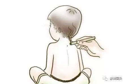 三伏灸一灸  疾病繞道走｜2021年“三伏灸”火熱進(jìn)行中！