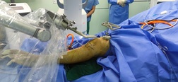 首例機器人輔助前交叉韌帶重建術(shù)在我院成功實施