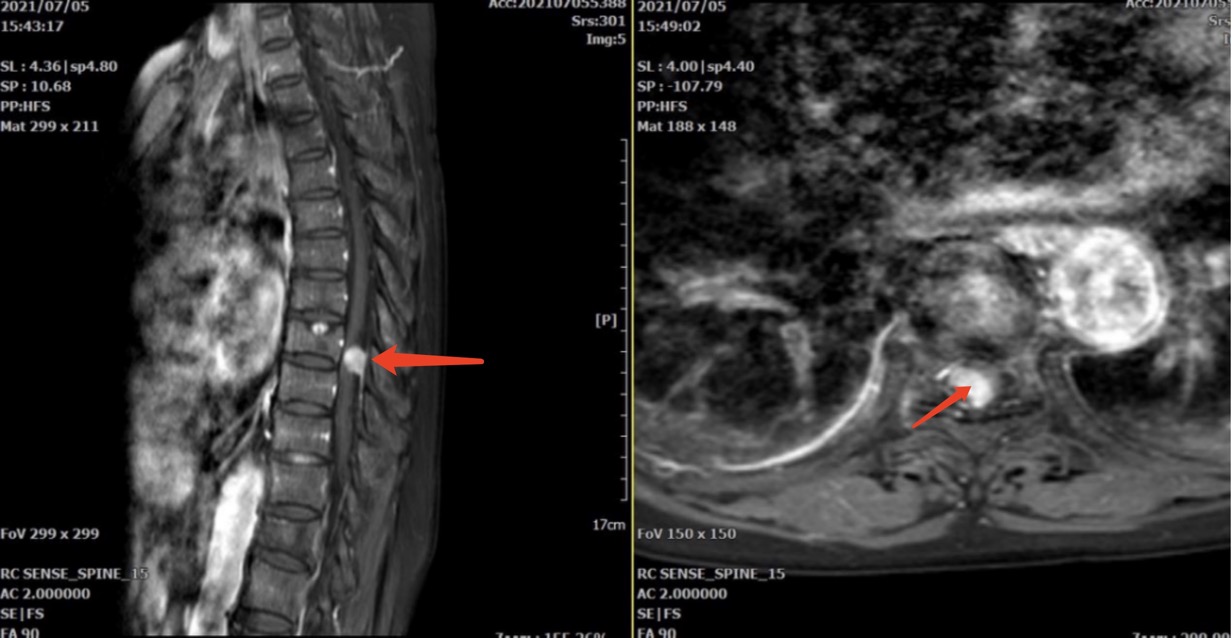 骨科手術(shù)機器人助推我院骨傷科躍進精準(zhǔn)治療新高地