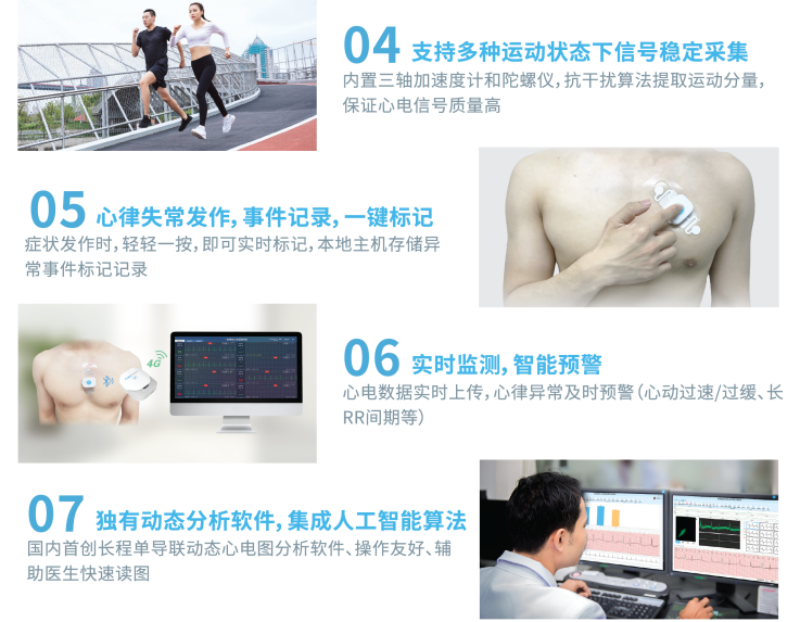 長程動(dòng)態(tài)心電圖——讓心臟的潛伏殺手無所遁形