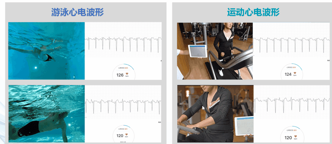 長程動(dòng)態(tài)心電圖——讓心臟的潛伏殺手無所遁形