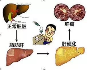 我的【肝】真的“受傷”了
