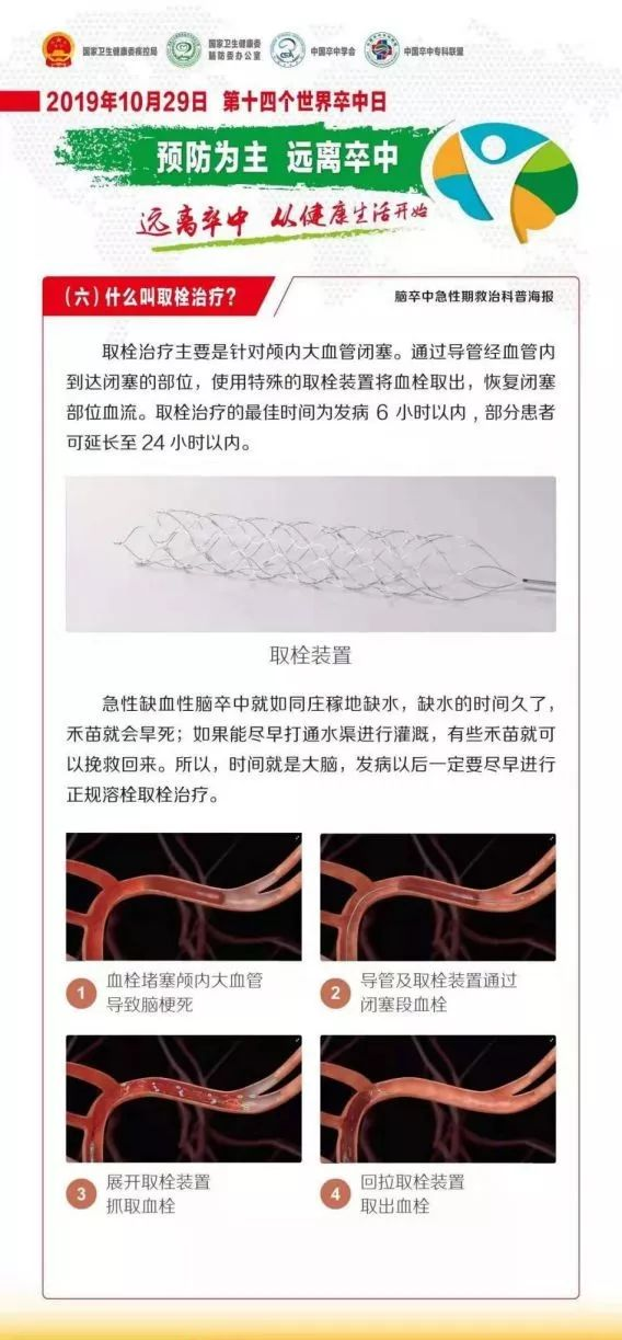 “世界卒中日”遠(yuǎn)離卒中，從健康生活開始